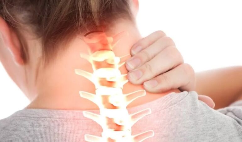 Osteohondroza prvog stupnja