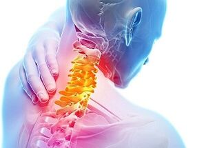 Uzroci cervikalne osteohondroze